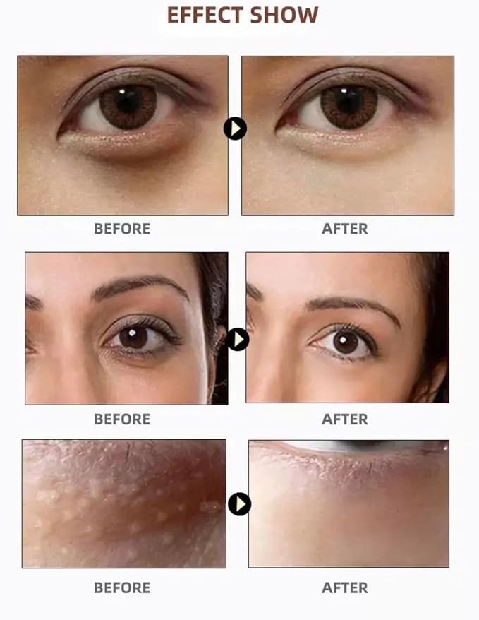 PURABEAUTY Advanced Eye Treatment Mask, Anti-Aging, Reduce Wrinkles and Fine Lines, Under Eye Treatment For Dark Circles, Under eye Mask For Puffiness- 60 PCs