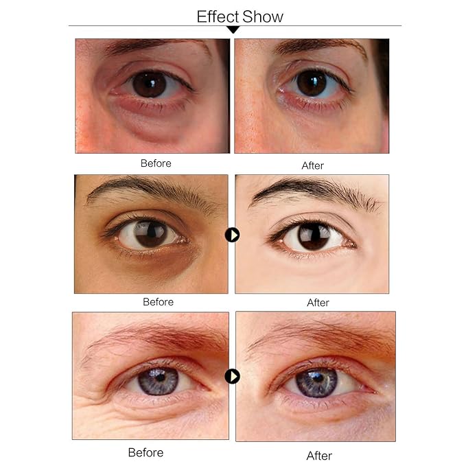 Under Eye Patches, 24K Gold Collagen Eye Mask for Puffy Eyes and Dark Circles Treatment, Under Eye Mask for Bags and Wrinkles, Eye Skin Care Pads for Beauty & Personal Care (60Pcs)