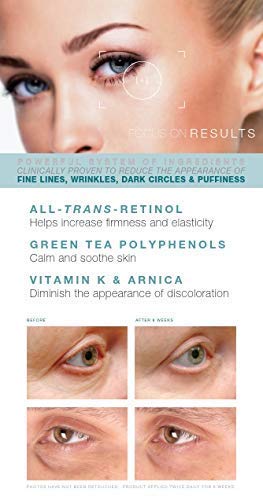 Under Eye Repair Cream - All-Trans-Retinol UNDER EYE REVIVE Anti Aging Eye Cream For Dark Circles And Puffiness, Under Eye Bags, Fine lines, Wrinkles - 0.5 Oz