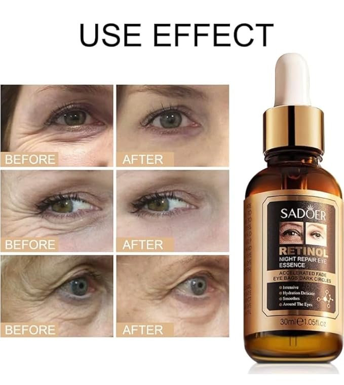 SUERO FACIAL RETINOL EYES NIGHT REPAIR 30 ml, Gold