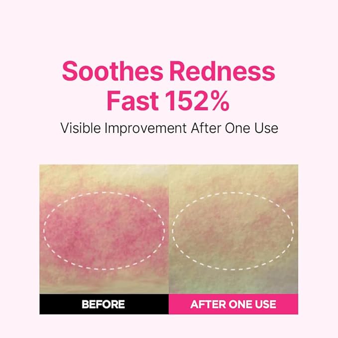 ISOI Blemish Care Up Serum for Face, Vegan Hydrating Serum for Smooth & Glass Skin Effect, Skin Barrier & Moisture Balance for Women, Korean Skin Care (0.85 fl. oz, 25ml)