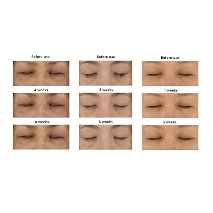 Fermentation Peptine Eye Care Cream 45ml /1.52oz with 8 peptide K-beauty Tube Type…