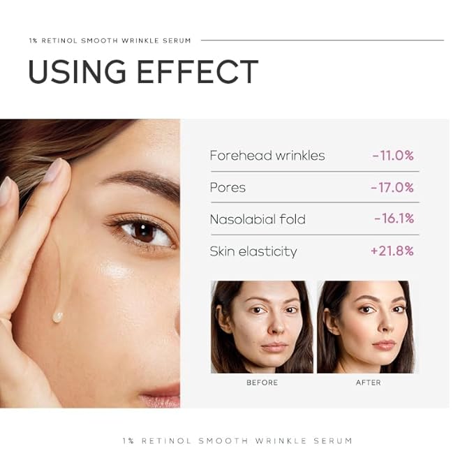 Anti Aging Skin Care Set, 1% Retinol Dark Spot Remover for Face with Face Serum & Moisturizer, Travel Size Skincare Set for Women, Reduce Wrinkles, Firm & Hydrate for All Skin Types