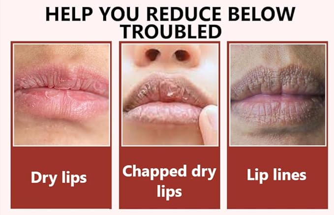 Sugar Lip Scrub - Gentle Lip Care Lip Exfoliator & Moisturizer - Exfoliating Lip Scrubber for Dry Lips