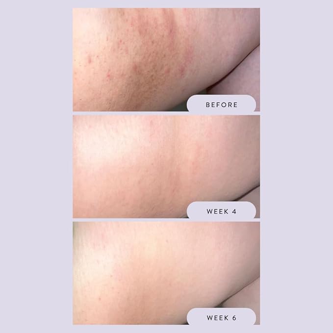 Megababe Night Rescue | Brightening & Soothing | 2.12 oz