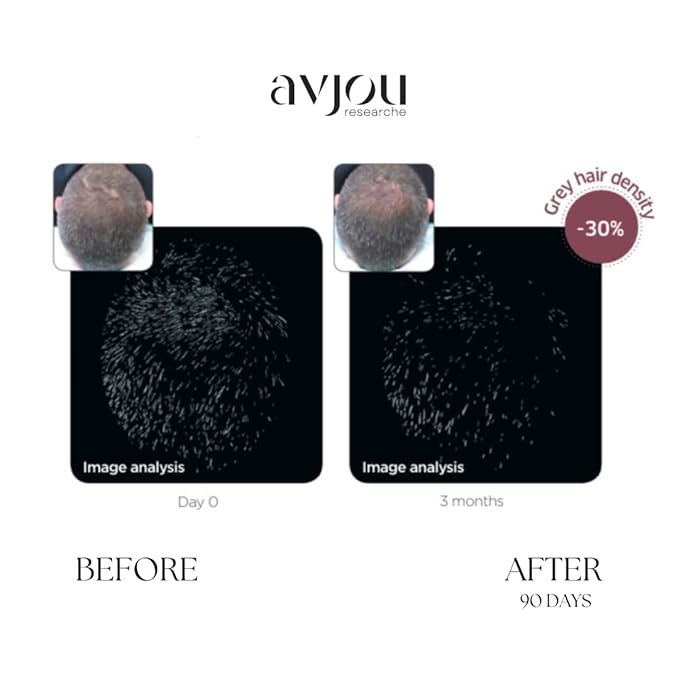 Avjou Researche™ Scalp Serum – Thicker, Fuller-Looking Hair + Targets Visible Signs of Premature Greying – 3 Patented Ingredients – Backed by Cosmetic Science – Oil-Free, All Hair Types, 1.7 oz