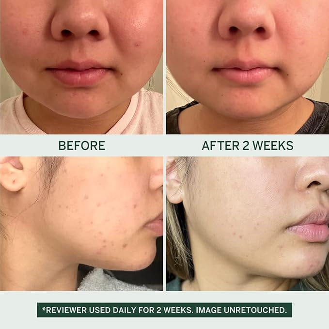 Urban Calm Discovery Bundle - Hydrating, Smoothing, Exfoliating, and Soothing Travel Size Skincare Set for All Skin Types - Fermented Skincare Products Include Cleanser, Essence, Serum, and Cream