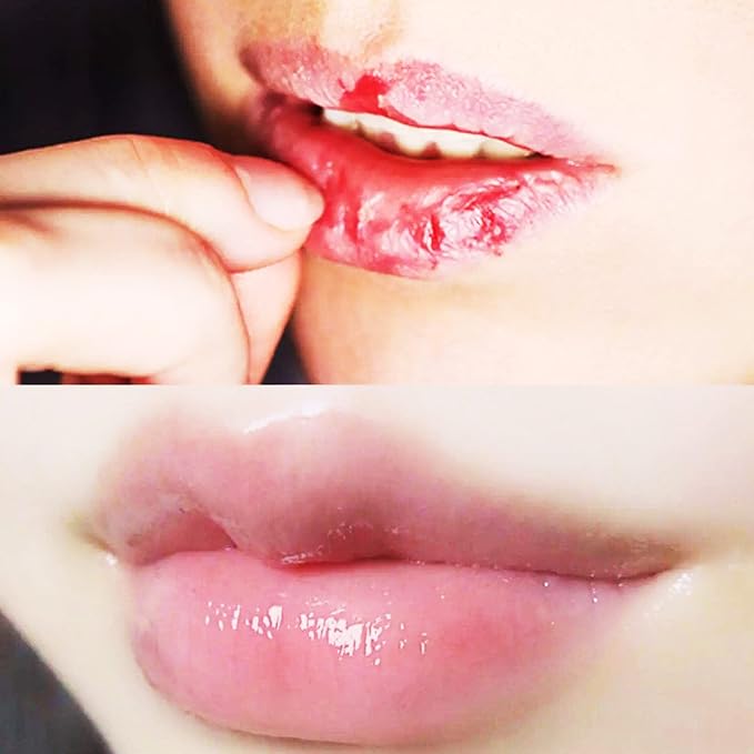 Lip Masks Sheet,Moisturizing Crystal Collagen Gel,Anti-Aging Lip Patches Reduces Lip Lines,Plump Dry Lips Overnight Lip Care,Fall/Winter Collagen Lip Sleep Mask 20 Packs with Box,Red