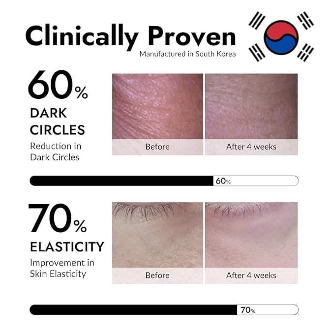 MIZON 24K Gold and Snail Mucin Hydrogel Under Eye Patches for Puffy Eyes Dark Circles Moisturizing Fine Lines Korean Skincare Pack of (Pack of 2, 120 Pairs)