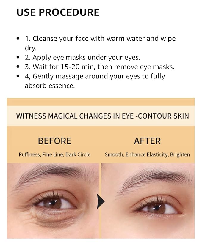 Under Eye Patches (30pcs) - Rose, Gold, hydro-gel Under Eye Mask Amino Acid & Collagen, Under Eye Mask for Face, Dark Circles and Puffiness, Beauty & Personal Care