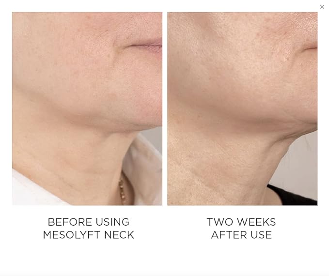 Power Combo Neck & eye Roller Brightening Face Serums for Anti-Aging Get Lip Pump's best Lip Plumper an Effectively Aging Skin Serum Multi-purpose, Eyes Neck & Décolleté Beauty Serum