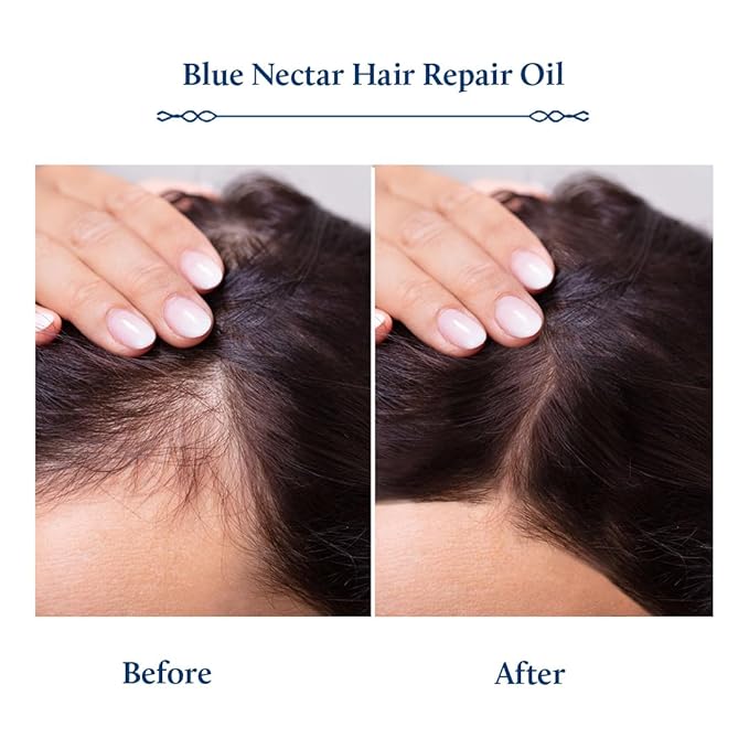 Blue Nectar Rosemary Oil with Bhringraj, Amla and 9 Herbs for Natural Hair Growth (6.76 Fl Oz)