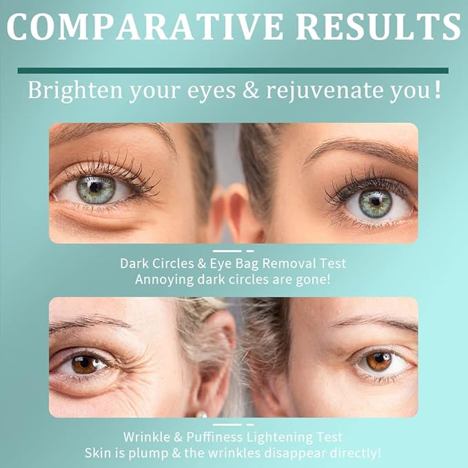 Under Eye Patches, Green Tea Under Collagen Eye Masks for Dark Circles Puffiness Eye Bag Wrinkles, Under Eye Treatment for Men Women, Anti-Aging Brightening Under Eye Gel Pads, 30 Pairs