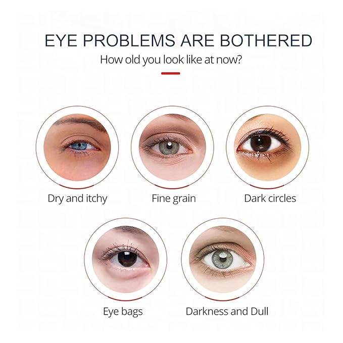 Open eyes awaken peptide lifting eye gel,peptide eye lifting gel,Reduces Dark Circles, Dark circles Hydrating firming Eye cream (5PCS)