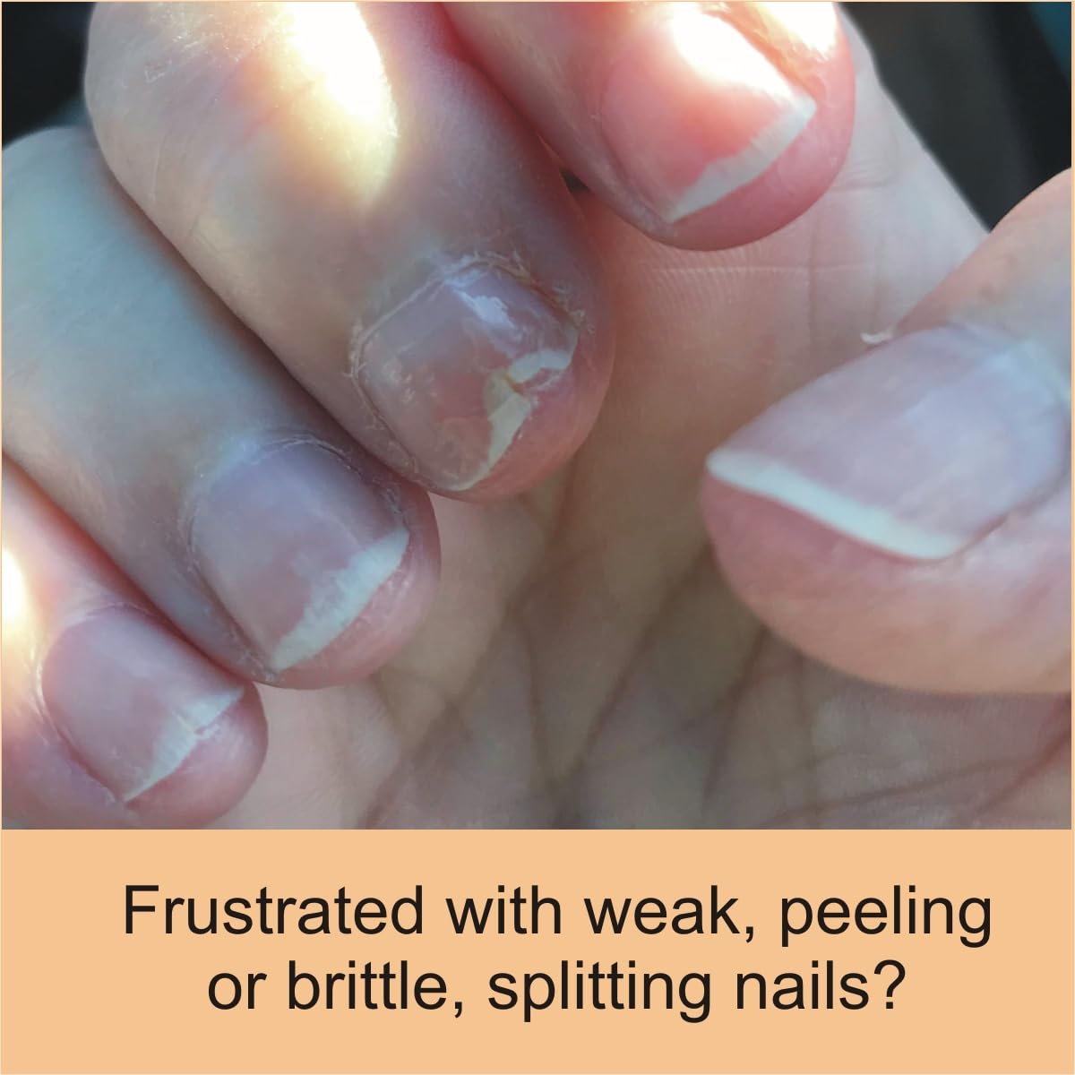 Penetrating Fingernail Conditioner and Strengthener to repair and then maintain weak and peeling or brittle and splitting nails