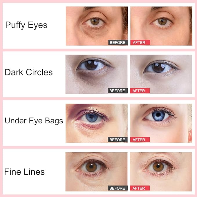 Retinol Eye Stick,Collagen Retinol Eye Cream for Dark Circles and Puffiness, Under Eye Cream Anti Aging, Eye Brightener Stick for Wrinkles Eye Balm Reduces Fine Lines(#1-Retinol Eye Stick)