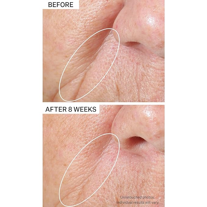 StriVectin Tighten & Lift Peptight Tightening & Brightening Face Serum with Peptides for Even Skin Tone, 1.7 Fl Oz