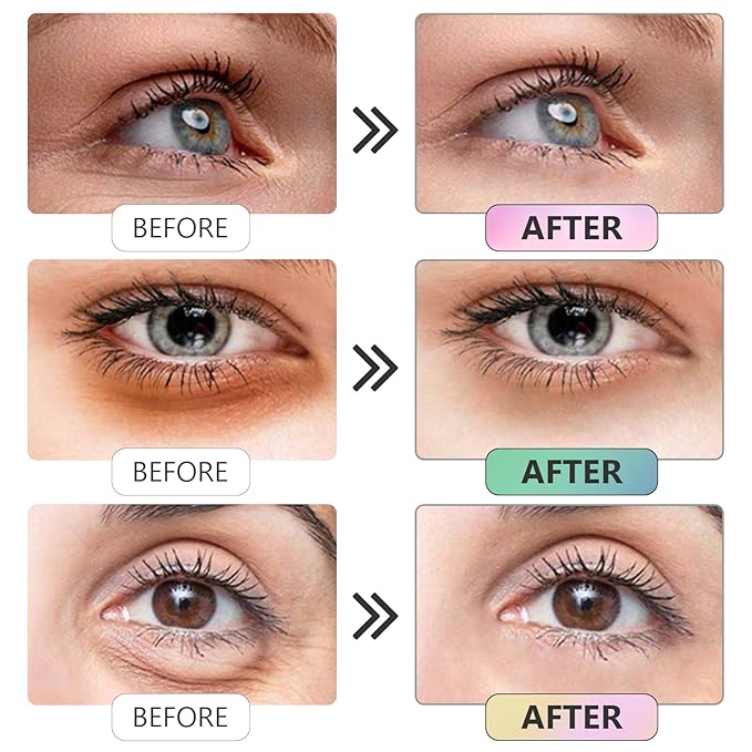 Under Eye Patches -30 Pairs Caviar Essence Eye Mask Eye Pads for Puffy Eyes, Reducing Dark Circles, Anti-Aging, Collagen Eye Mask for Moisturizing, Gold