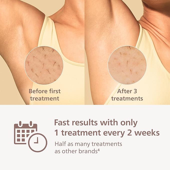 Philips Lumea 8000 Series IPL Hair Removal Device - Alternative to Laser Hair Removal, SenseIQ Technology and Lumea App, 3 Attachments for Body, Face, and Precision, for Women & Men, BRI937/03