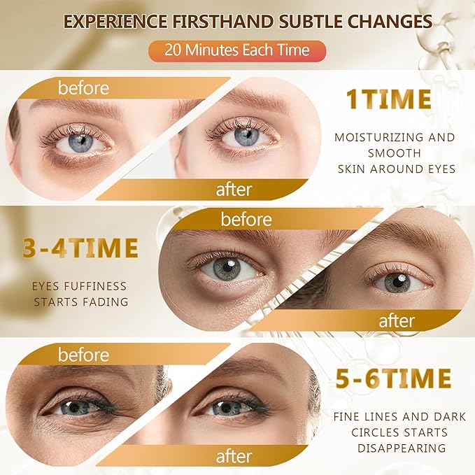 60 Pcs 24K Gold Under Eye Patches, 30 Pairs Undereye Mask for Dark Circles Puffy Eyes Treatment, Collagen Gel Pads Hydrating for Puffiness Wrinkle Eye Bags, Women Men Beauty Skin Care Products