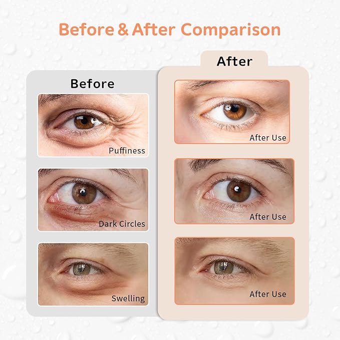 Gel Ice Pack Reusable Cooling Eye Pads and Under Patches,Eye Hot Cold Treatment for Redness,Pain Relief Relax (Oranges)