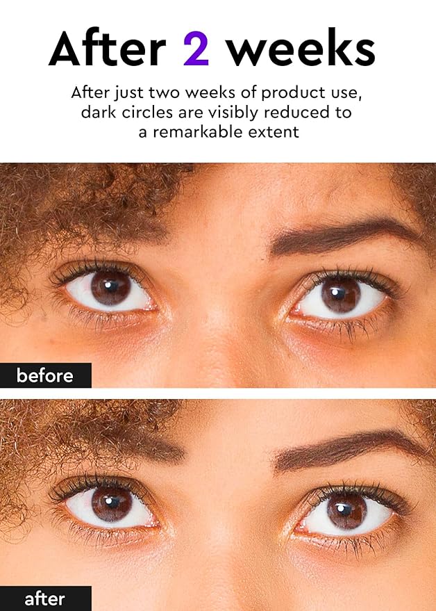 Bewants Eye Cream Stick for Wrinkles | Under Eye Cream For Dark Circles and Puffiness | Eye Cream for Puffiness and Bags Under Eyes | Hydrating Eye Cream for Sensitive Skin | Korean Skincare