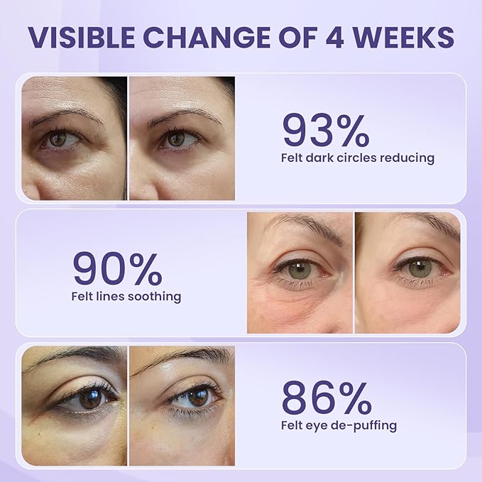 Retinol Eye Cream, Under Eye Cream for Dark Circles and Puffiness, Anti-Aging Eye Cream for Wrinkles, Eye Theatment with Lotus Leaf Extract, Made in USA