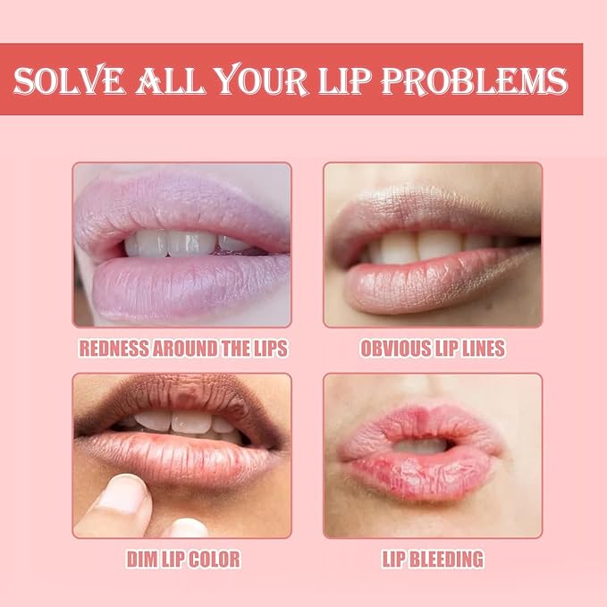 3 PCS Bee Lip Balm Honey Pot, Exfoliating Honey Strawberry Watermelon Lip Mask Overnight with Built-In Brush, Hydrating Prevention Dry and Crack Lip Scrubs Exfoliator Lip Wrinkle Care