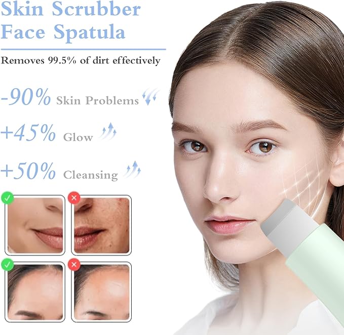 Skin Scrubber Face Spatula Skin Spatula Pore Cleaner Blackhead Remover Tools for Facial Deep Cleansing Skin Care Tool for Men and Women (Green)