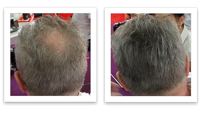 Trial Size - Make Thin Hair Look 10X Fuller. Eliminate Bald Spot and Thinning Hair Instantly. All-Natural Hair Concealer. Salt & Pepper - Light