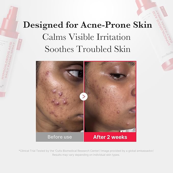 medicube Power Soothing Spray | Hypochlorous Acid Spray For All Skin Types, Delicate Skin | Daily Skin Solution & Post-Sun Care | HOCI Facial Mist for Soothing & Calming | Korean Skincare | 4.22 fl.oz