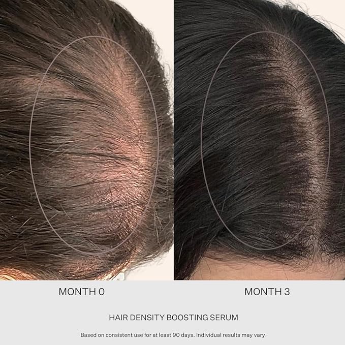 Peptide & Stem Cell Hair Growth Serum, AM & PM Bundle – Formula with Apple Stem Cells for Thicker, Stronger Hair – Stem Cell Scalp Serum for Hair Growth and Nourishment for Men & Women