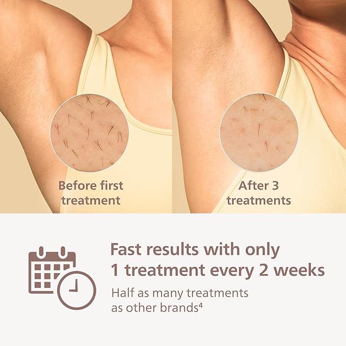 Philips Lumea 7000 Series IPL Hair Removal Device - Alternative to Laser Hair Removal, SenseIQ Technology and Lumea App, 1 Attachment for Body for Women & Men, BRI931/03