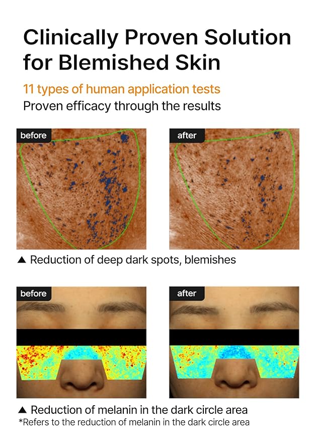 celimax Pore+Dark Spot Brightening Cream | with Niacinamide, Tranexamic Acid, TXA Cream, Pore Minimizer, Non-Irritating, Hydrating, For Sensitive Skin, 35ml