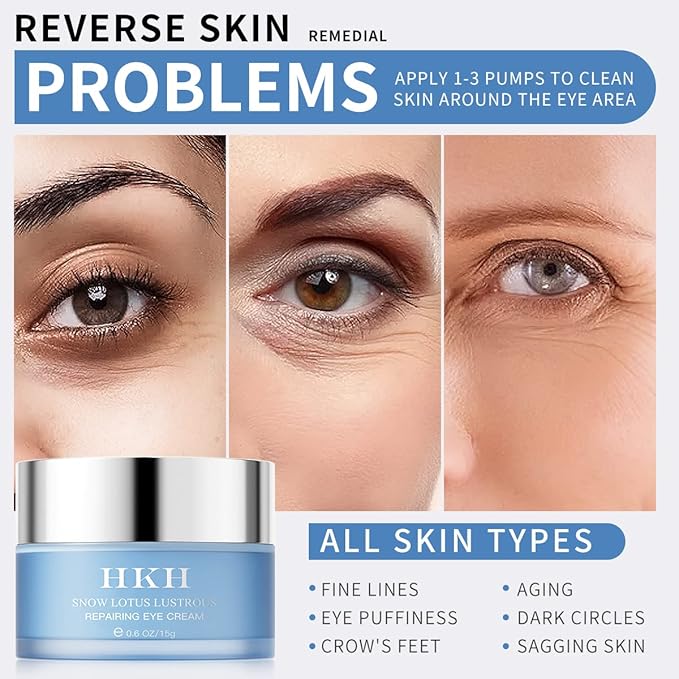 Dark Circles Under Eye Treatment for Women - Eye Cream for Dark Circles Wrinkles Puffiness & Fades Eye Wrinkles – Brighten the Eye Area Anti-Aging Collagen Eye Cream – Retinol Peptide