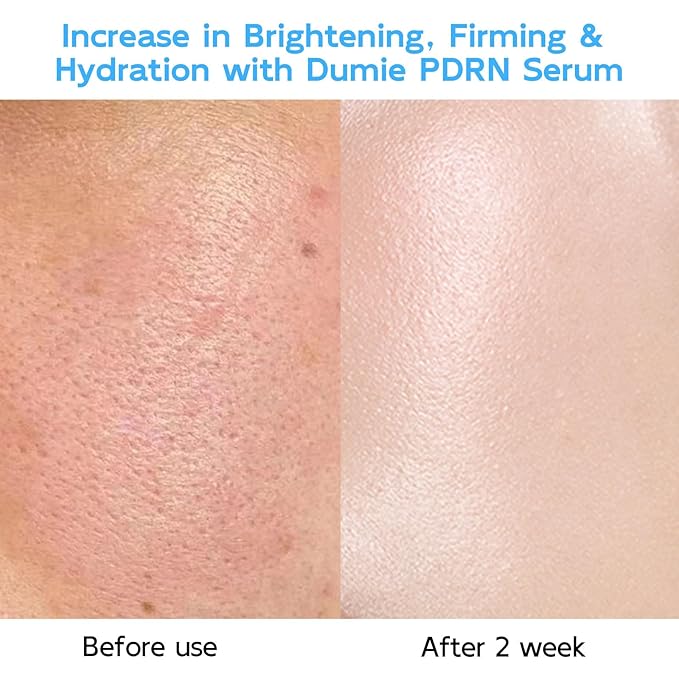 Salmon DNA PDRN Anti-Aging Serum, 5000ppm Salmon Egg DNA Ampoule, 2000ppm Collagen, Glutathione, Niacinamide & 6 Hyaluronic Acids, Korean Skincare for Wrinkles & Radiance,0.05 fl.oz x 30e