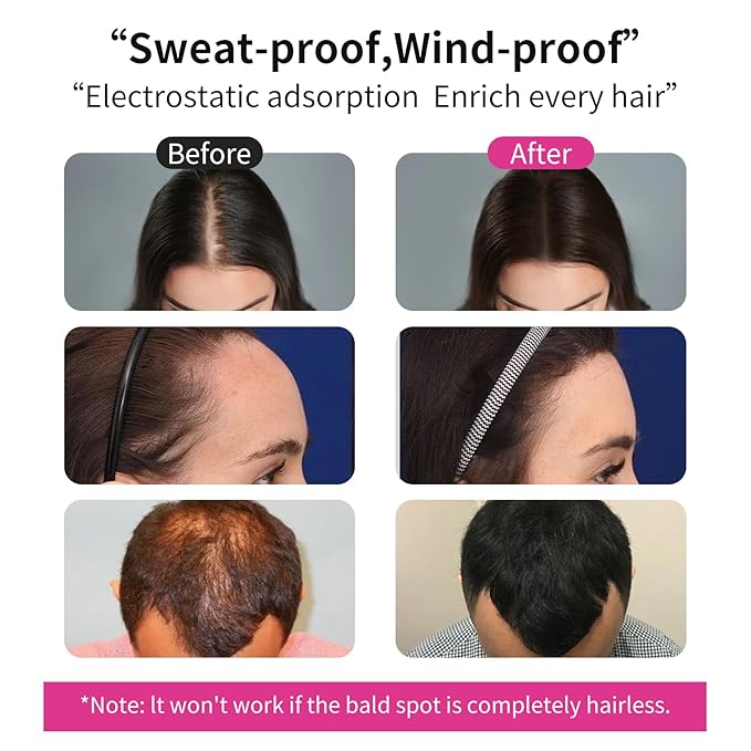 SEVICH Hair Fibers Refill 100g - Compatible with Most Brand Bottles | Hair Building Fibers for Thinning Hair | Instant Thickening Powder for Men & Women | 5-Second Natural Coverage,Medium Brown