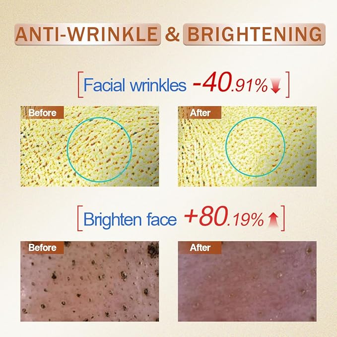 Vitamin C Serum for Face with Hyaluronic Acid, Boost Skin Collagen, Brightening, Antioxidant, Anti-Aging, Hydrate & Plump, Improve Appearance of Dark Spots, Tone, Fine Lines Facial Serum 30ml/1 fl oz