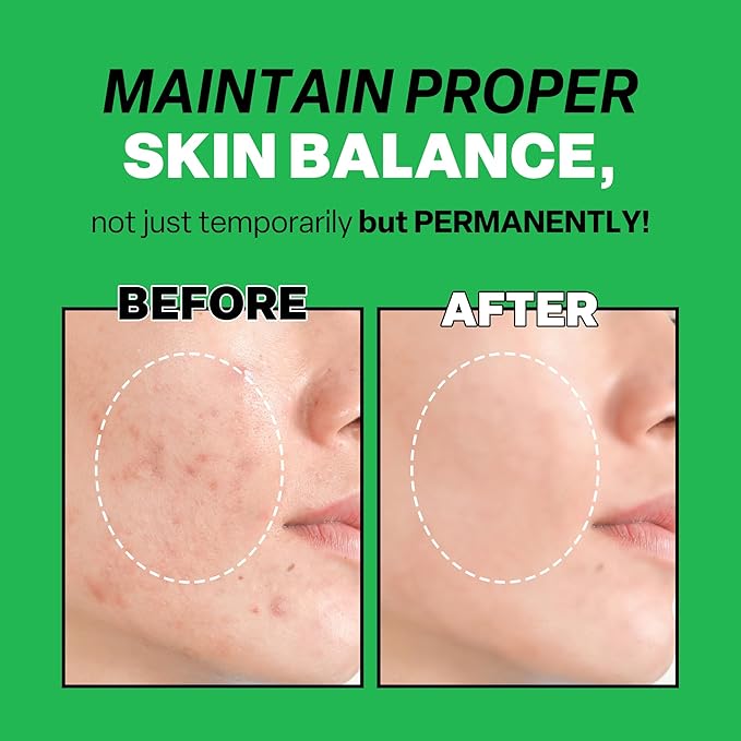 Troubless Mild Clear Toner Essence - Tea Tree Facial Toner for All Skin Types | Hydrating Skin Toner, Daily Skin Care (6.76 fl oz)