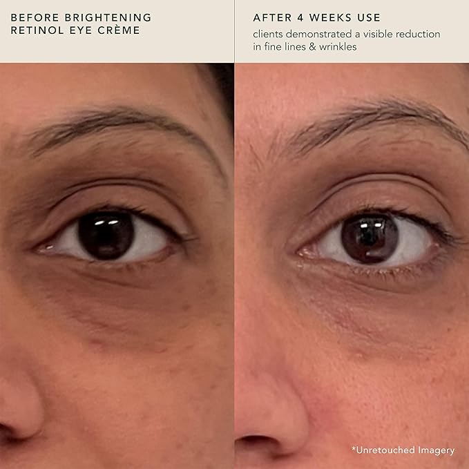 RANAVAT Brightening Retinol Eye Cream - Anti Aging Eye Cream and Dark Circle Corrector to Help Target Fine Lines - Enriched with Micro-Encapsulated Retinol, Bakuchi Seed, & Saffron (0.5 oz)