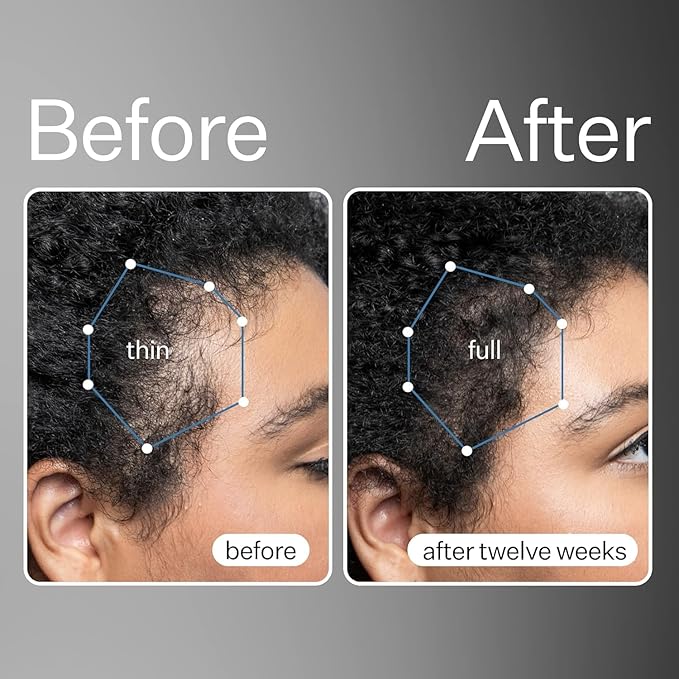 Act+Acre 3-Pack Mini Cold Processed Stem Cell Scalp Serum - Promotes Thicker, Fuller-Looking Hair - Soothes and Hydrates - Sulphate and Paraben Free - Aloe Vera for Improved Scalp Health