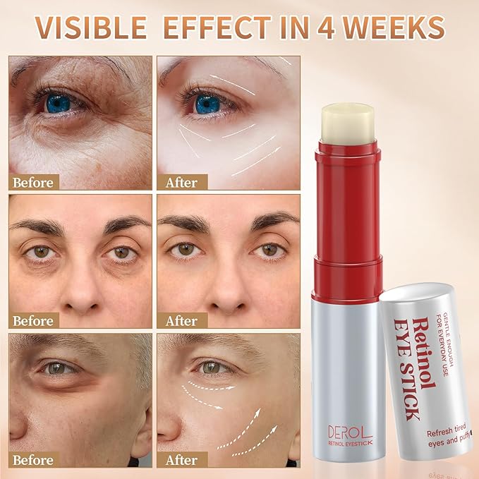 Retinol Eye Cream, Wrinkle Repair Eye Cream for Dark Circles, Under Eye Bag Cream with Retinol & Hyaluronic Acid, Eye Cream Anti Aging to Fight Fine Lines, Reduce Eye Bags,Wrinkles in 3-4 Weeks