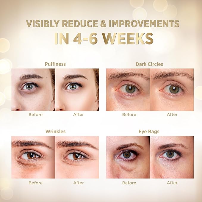 VELAMO ADVANCED Under Eye Patches: 24K Gold Under Eye Mask for Puffy - Retinol Patchology Eye Patches for Wrinkles and Dark Circles Puffiness- Collagen Under Eye Bags Treatment for Women Men 60 Pcs