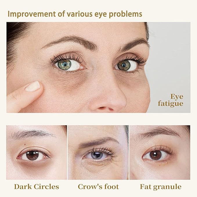 Under Eye Patches for Dark Circles and Puffy Eyes (30 Pairs), 24K Gold Eye Masks for Reducing Wrinkles and Fine Lines Under eye, Collagen Eye Gel Pads Improve and Firm Eye Skin, Natural Extract