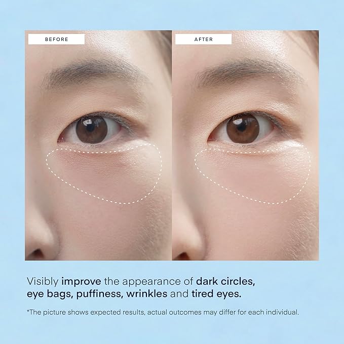 TEREZ & HONOR Under Eye Patches for Dark Circles - 60 Korean Hydrogel Masks for Puffiness, Bags with Caffeine, Hyaluronic Acid, Niacinamide - Undereye Brightening, Hydrating, Anti-Wrinkle & Cooling