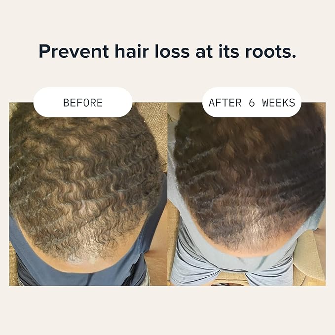 CARDON Hair Growth Shampoo for Men - Thickening, Anti-Thinning, Strengthens Roots, Korean Skincare for Healthy Scalp, Suitable for Oily and Dry Hair