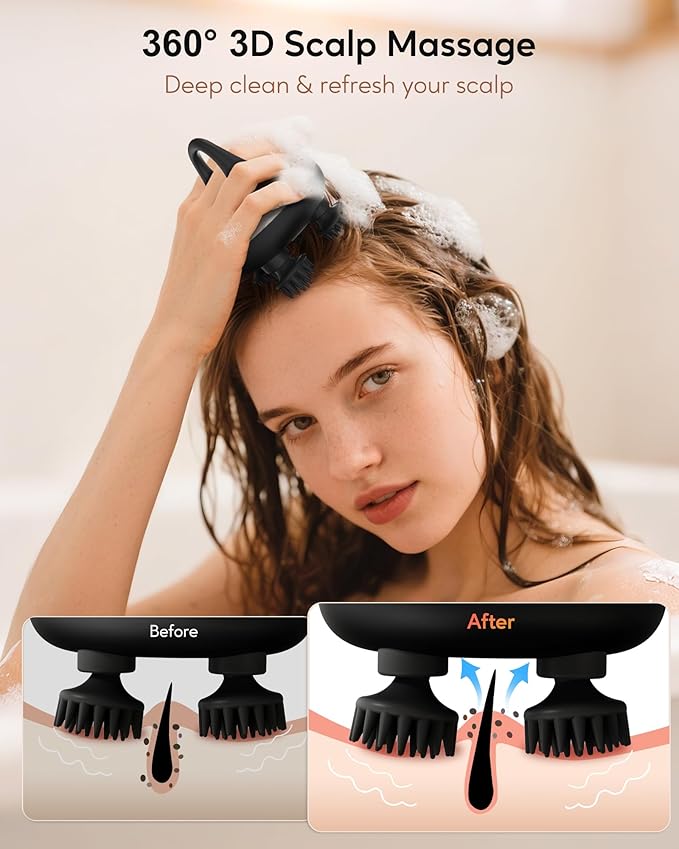 arboleaf Electric Scalp Massager Kneading Head Massager Scalp Stress Relax, Portable 6 in 1 Hair Massage with 12 Removable Massage Claws, Recharagable Head Stratcher, Gift for Mom Dad