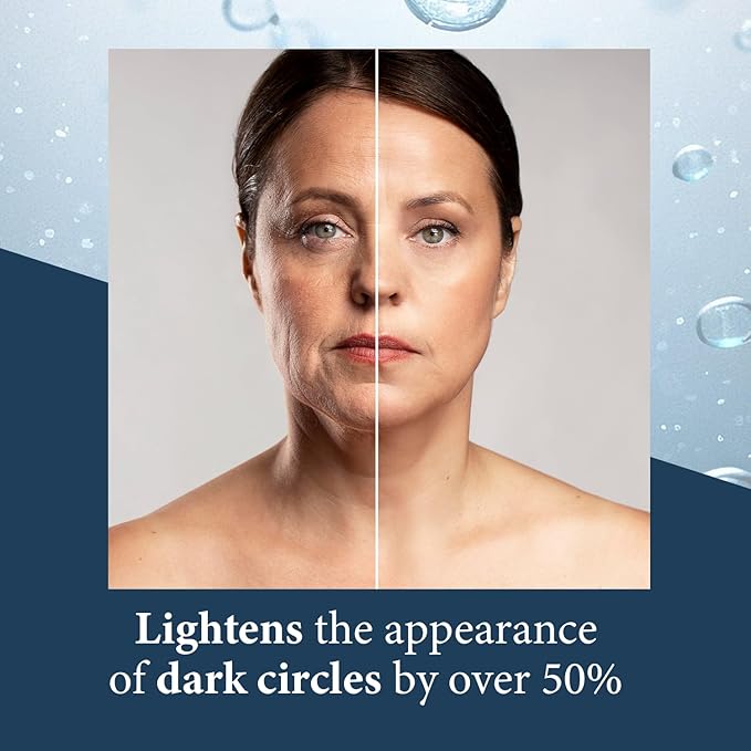 Elite Serum Rx - Anti Aging Under Eye Serum for Dark Circles and Puffiness with 8 Patented Peptides - Extra Strength Lifting and Firming Treatment for Wrinkle Repair and Eye Bag Removal