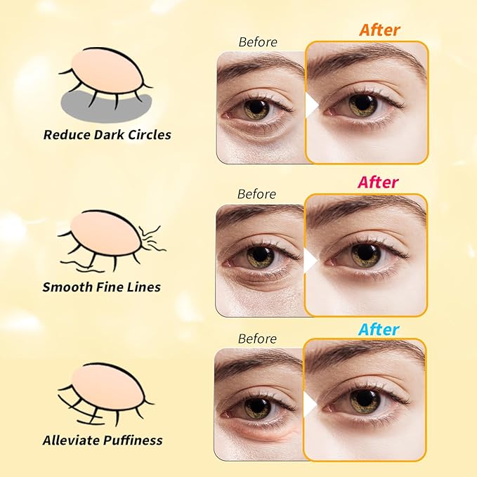 Under Eye Patches(12 Pairs), 24K Gold, Caffeine, Retinol Eye Masks for Puffy Eyes, Wrinkles, Dark Circles, Undereye Bags Treatment - Restoring & Awakening & Moisturizer Skin care Gift for Women