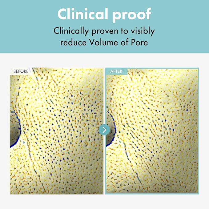 Pore Refiner Cream, Face Cream, Pore Extractor, Pore Minimize & Reducer and Remover. Best Pore Minimizer Treatment. Moisturizer for Oily Skin. K Beauty, Korean Skincare, 50g, 1.76 oz.